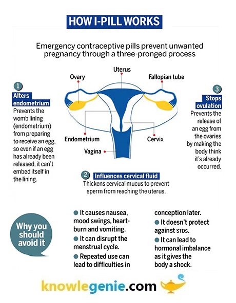 i-Pill Tablet आपातकालीन गर्भनिरोधक की सम्पूर्ण जानकारी